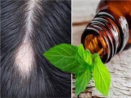 اعرفى أهم فوائد زيت النعناع للشعر وإزاى تستخدميه للتخلص من القشرة