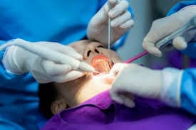 لو هتخلع ضرس العقل.. ما تفعله وما يجب تجنبه لمدة 48 ساعة