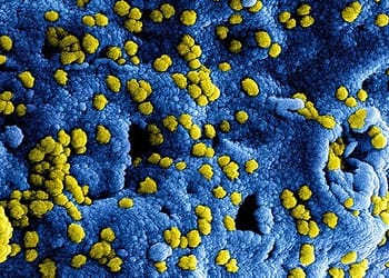 السعودية – توصيات من منظمة الصحة العالمية بعد تسجيل حالات جديدة من متلازمة الشرق الأوسط