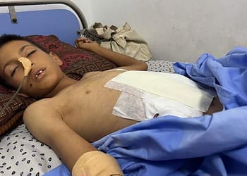 غزة – المستشفيات على وشك الانهيار وإسقاط المساعدات غير كاف لتجنب المجاعة