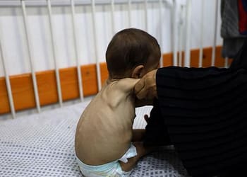 غزة – مزيد من الوفيات المرتبطة بالجوع، ووضع يفوق الكارثة