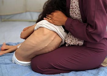 لأول مرة: تأكيد حدوث المجاعة في محافظة غزة وتوقعات بامتدادها إلى مناطق أخرى خلال أسابيع