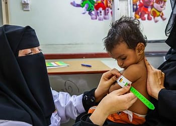 الأمم المتحدة: اليمن مرآة ومكبر لتقلبات المنطقة، ويجب ألا يحدد الجوع مستقبل البلاد