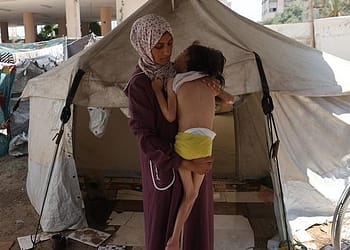 غزة – معدل سوء التغذية بين الأطفال يتجاوز الرقم القياسي   