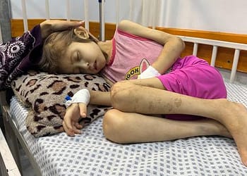 غزة – “العالم تخلى عن جنى”: لقيت مصرعها بسبب سوء التغذية