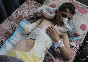 منظمة الصحة العالمية: مصابو غزة سيحتاجون إلى رعاية وإعادة تأهيل لسنوات قادمة