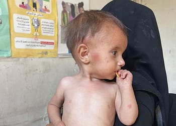 سوريا – الملايين تأثروا بخفض تمويل الخدمات الصحية، “جسر تعافي” البلاد غدا