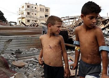 “انفجار بين الركام”، شقيقان من غزة يرويان لحظات تركت ندوبا غائرة على جسديهما