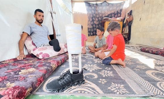 بُترت ساقه أثناء البحث عن الطعام في غزة، فصنع طرفا صناعيا وعاد ليحاول تأمين قوت أسرته