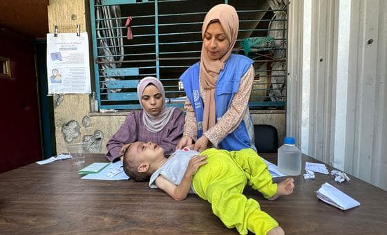 غزة: استمرار الأعمال العدائية يعيق جهود مكافحة سوء التغذية