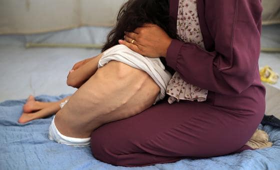 خسائر فادحة بين المدنيين في غزة، وسرقة أغذية علاجية مخصصة للأطفال الجوعى