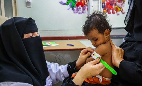 الأمم المتحدة: اليمن مرآة ومكبر لتقلبات المنطقة، ويجب ألا يحدد الجوع مستقبل البلاد