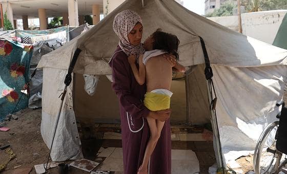 غزة – معدل سوء التغذية بين الأطفال يتجاوز الرقم القياسي   