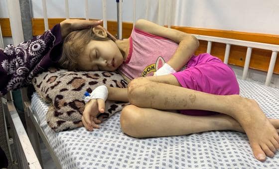 غزة – “العالم تخلى عن جنى”: لقيت مصرعها بسبب سوء التغذية