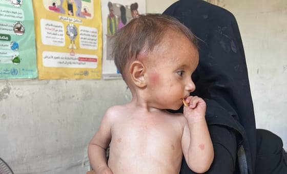 سوريا – الملايين تأثروا بخفض تمويل الخدمات الصحية، “جسر تعافي” البلاد غدا