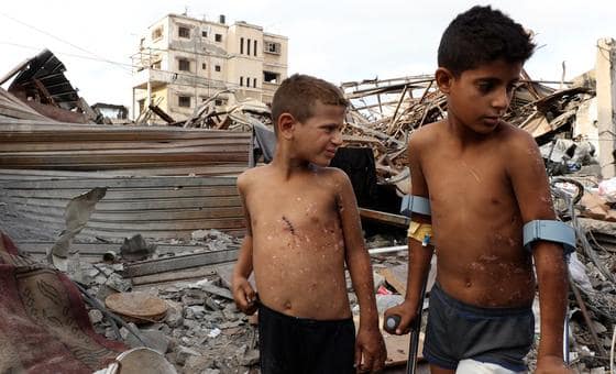 “انفجار بين الركام”، شقيقان من غزة يرويان لحظات تركت ندوبا غائرة على جسديهما