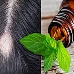 اعرفى أهم فوائد زيت النعناع للشعر وإزاى تستخدميه للتخلص من القشرة