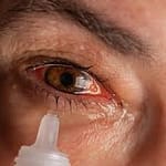 لماذا يحدث جفاف العين.. كل ما تريد معرفته عن الأسباب والعلاج