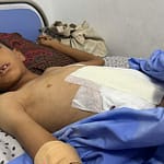 غزة – المستشفيات على وشك الانهيار وإسقاط المساعدات غير كاف لتجنب المجاعة